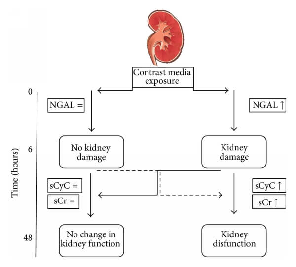 胱抑素C（CysC）與NGAL、肌酐的關(guān)系